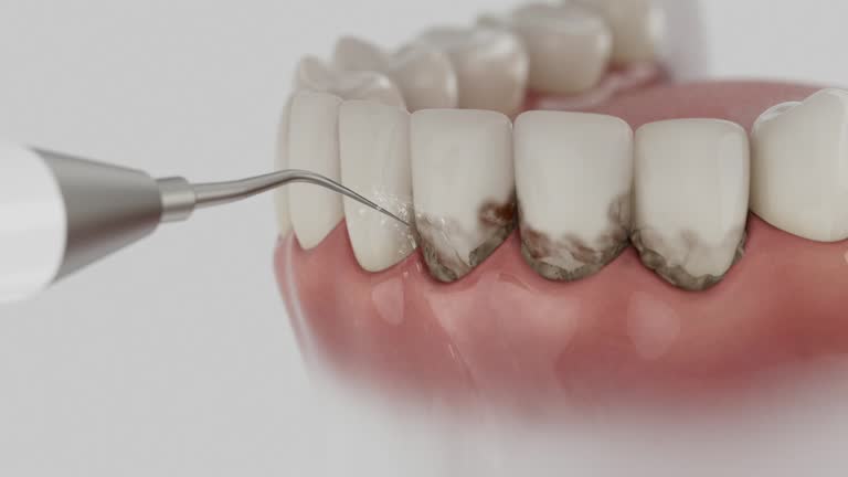Trusted Wisdom Tooth Removal service in Joseph City, AZ - Dentist Open Now